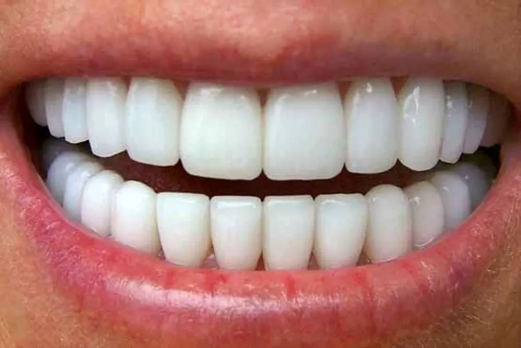 Top Teeth Infront Top Teeth Names: Amazing Guide To Anatomy - Gold City