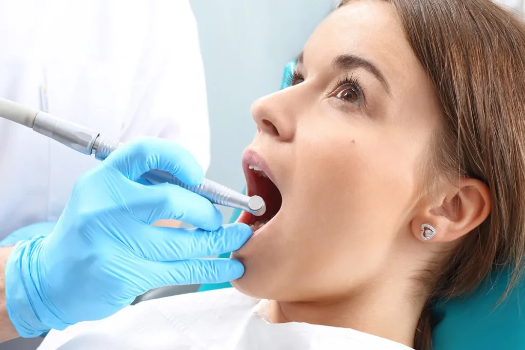 Root Canal Procedure: What to Expect | Gold City Dental