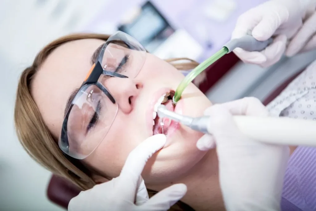 How to Know If You Need a Root Canal – Gold City Dental