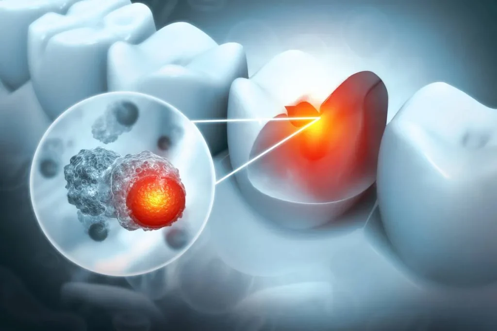 Tooth Infection Symptoms: Best Amazing Tips - Gold City