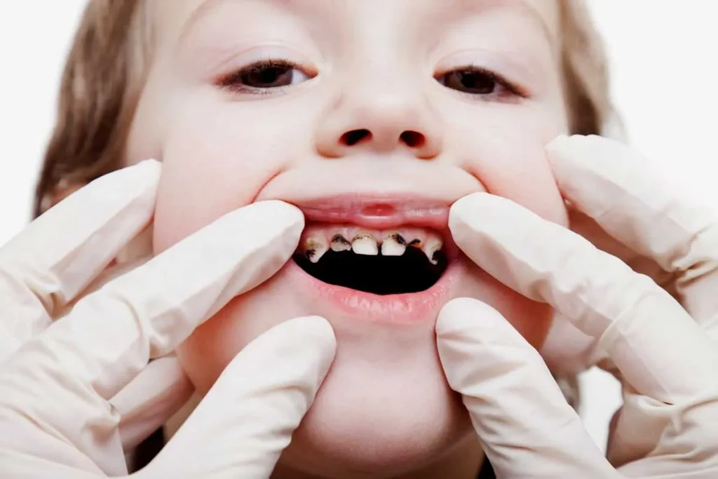 Fresh Breath Tips: How to Make Your Breath Smell Good