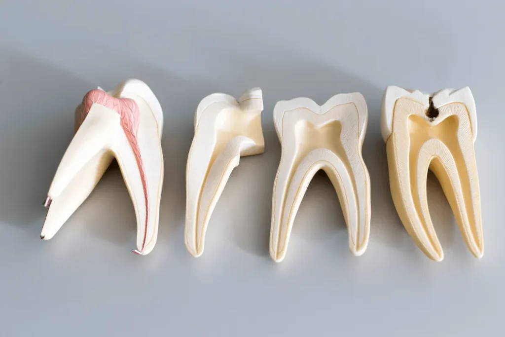 How Many Roots Do Molars Have? Amazing Guide - Gold City