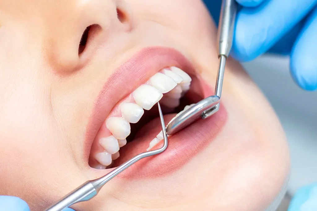 Choosing the Right Dentist for Your Oral Health – Gold City