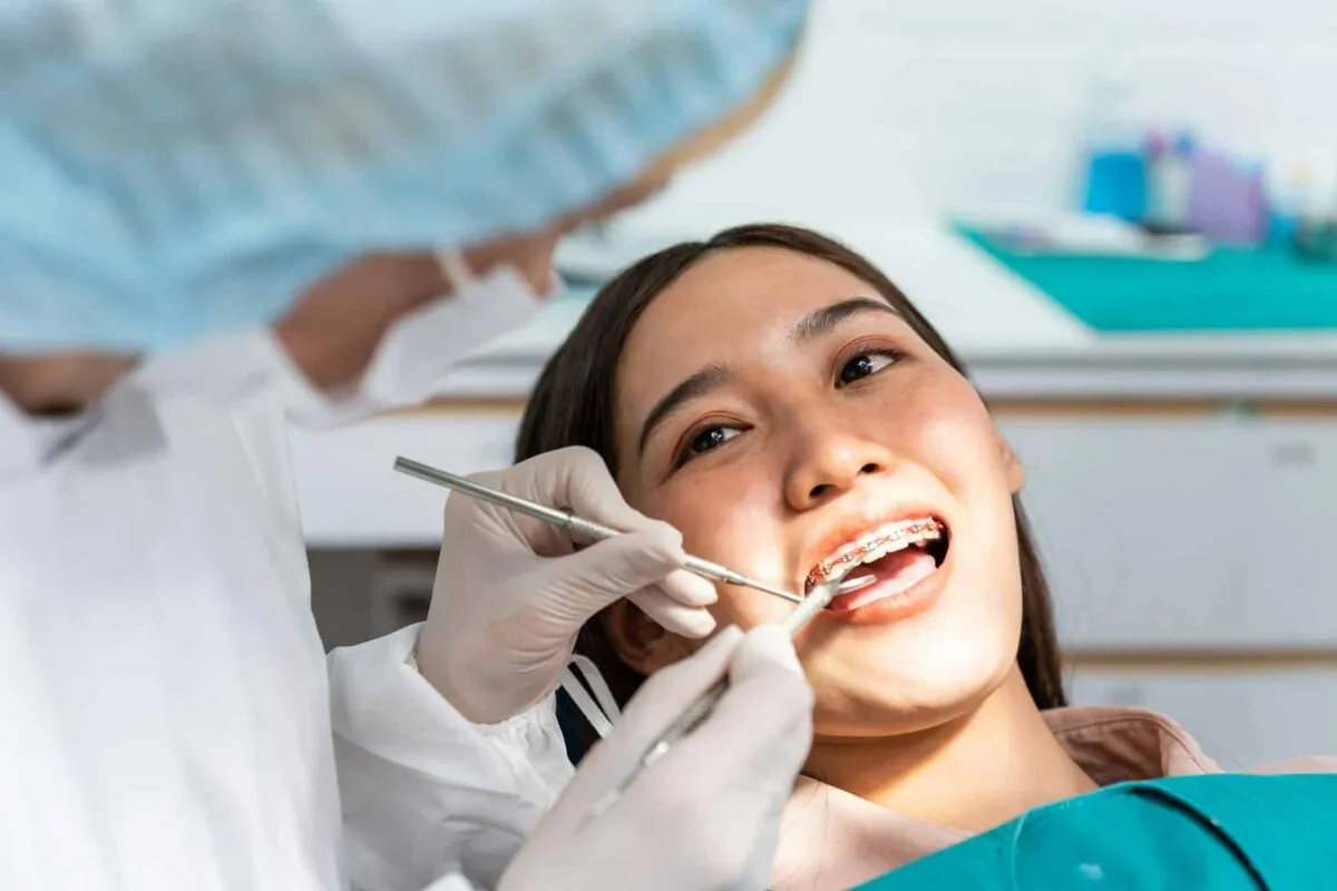 Evaluating Spark Aligners: Clear Orthodontic Device Review