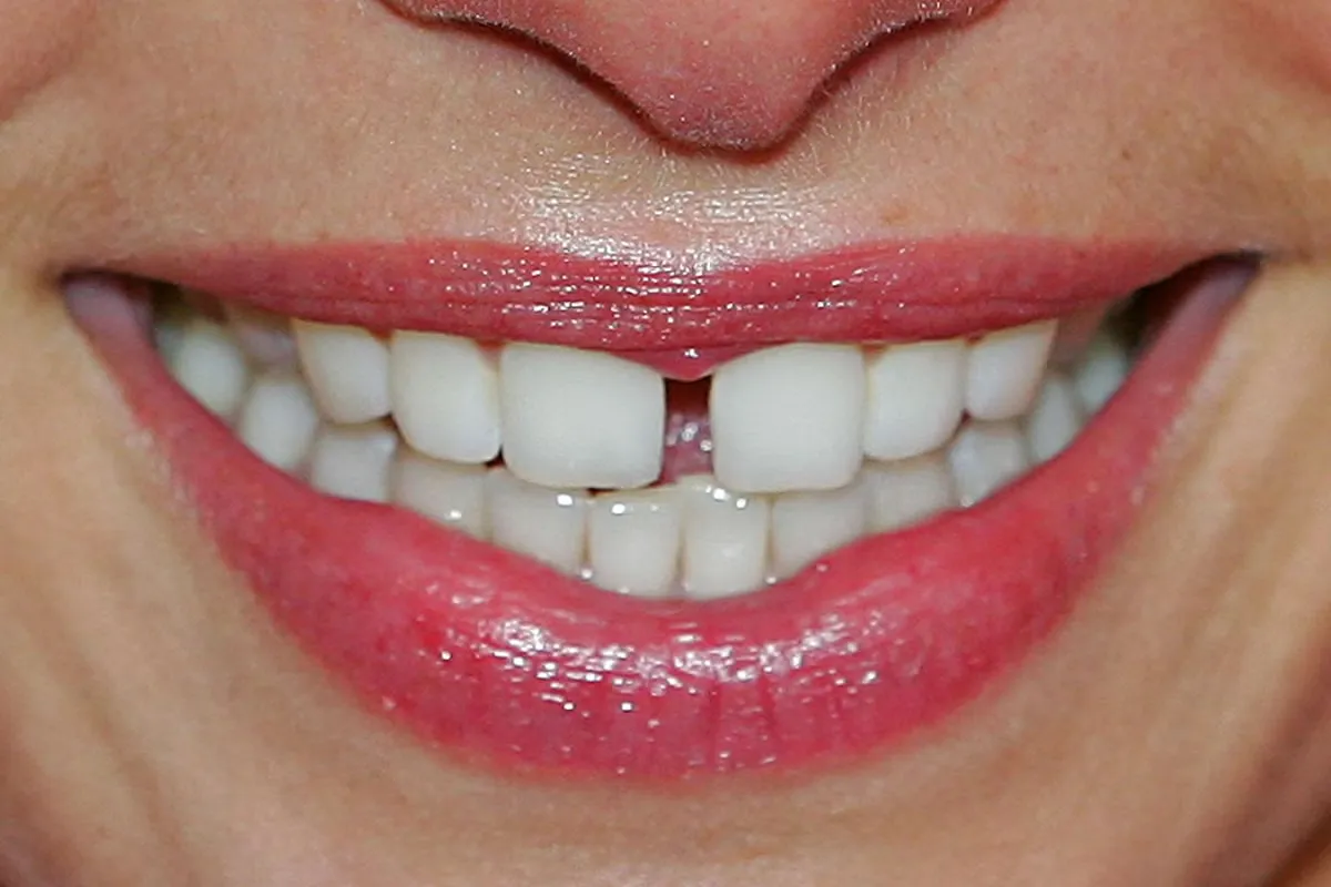 Oral Health Guide: Essential Tips for a Healthy Smile