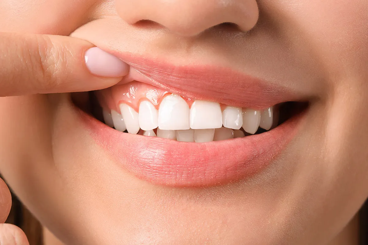 How Should My Teeth Line Up? Amazing Best