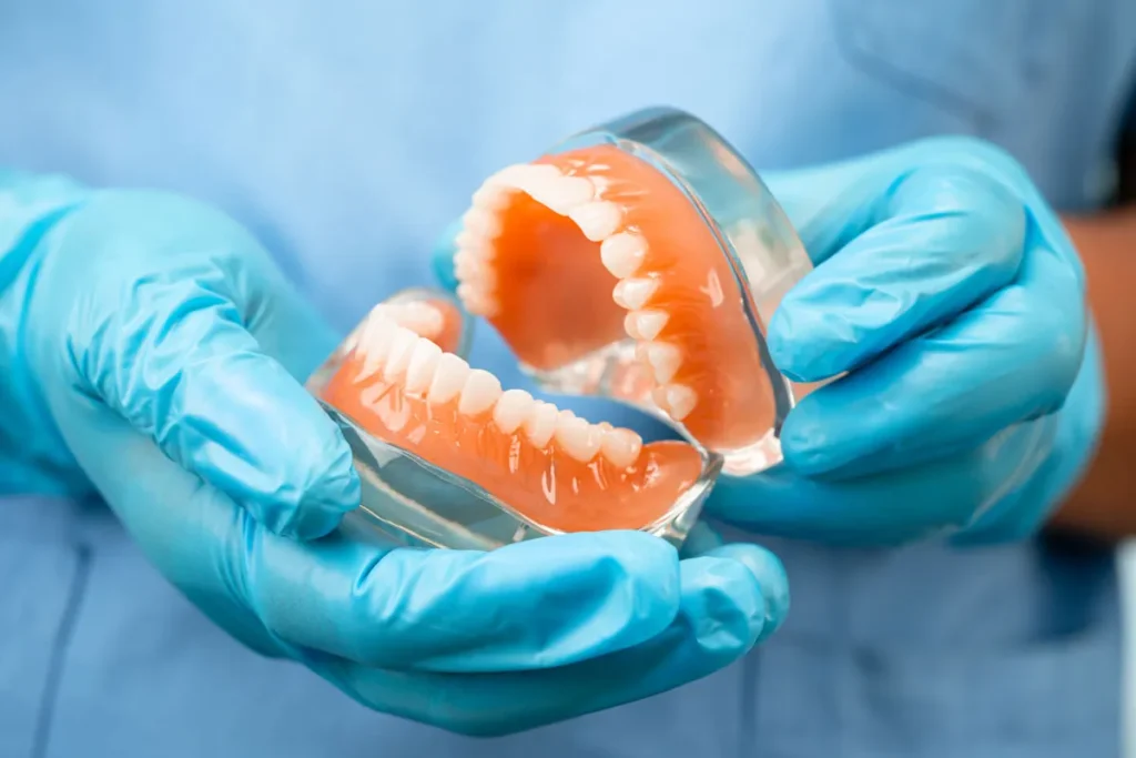 Partial Dentures Vs Implants: Best Choice