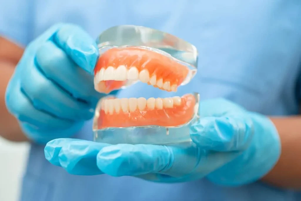 Partial Dentures vs Implants: A Comparative Look