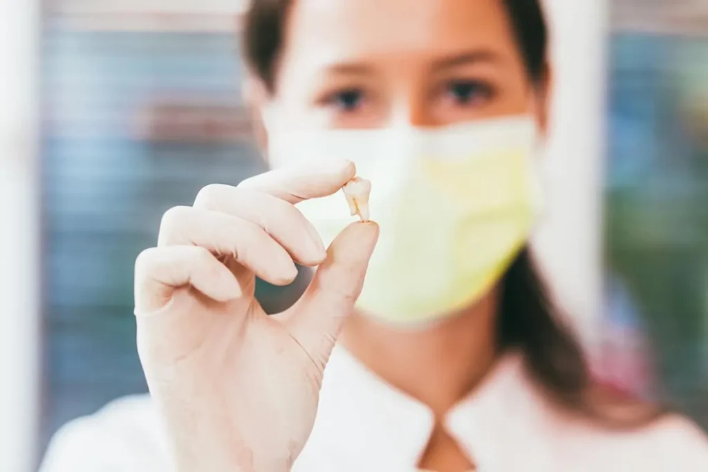 How to Get Rid of Pericoronitis with Natural Remedies