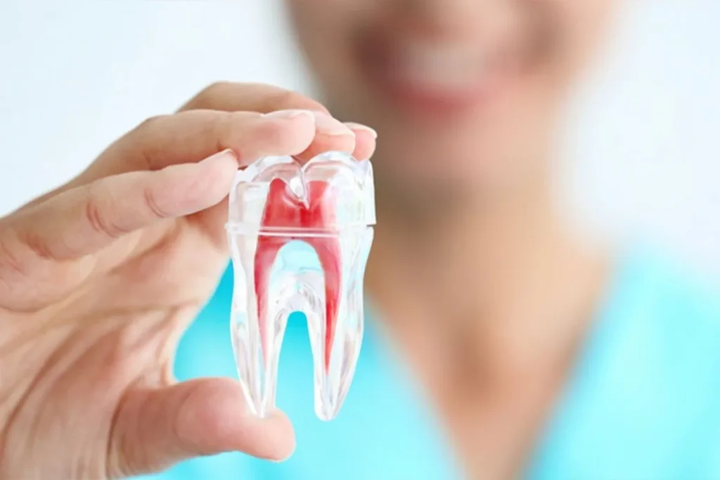 The Root Canal Procedure: Step-by-Step Experience