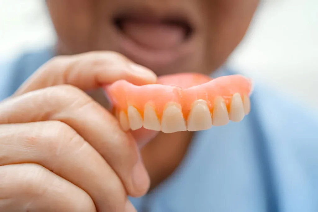 Healing Dentures: Best Amazing Smile Tips