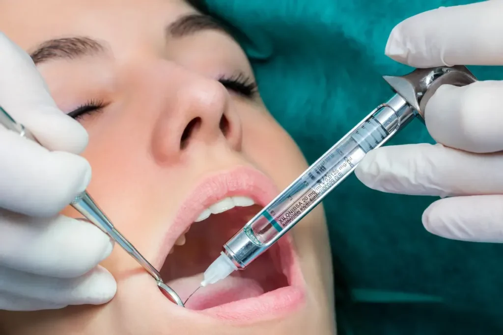 Maxillary Injection Sites and Techniques