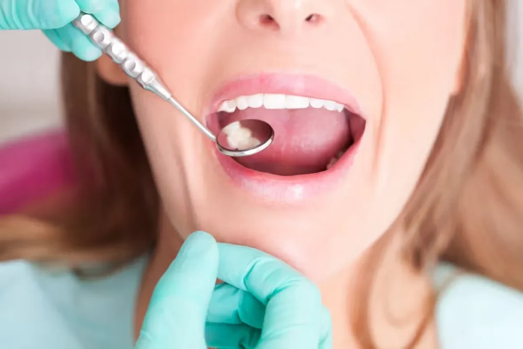Understanding Teeth Filing: What You Need to Know
