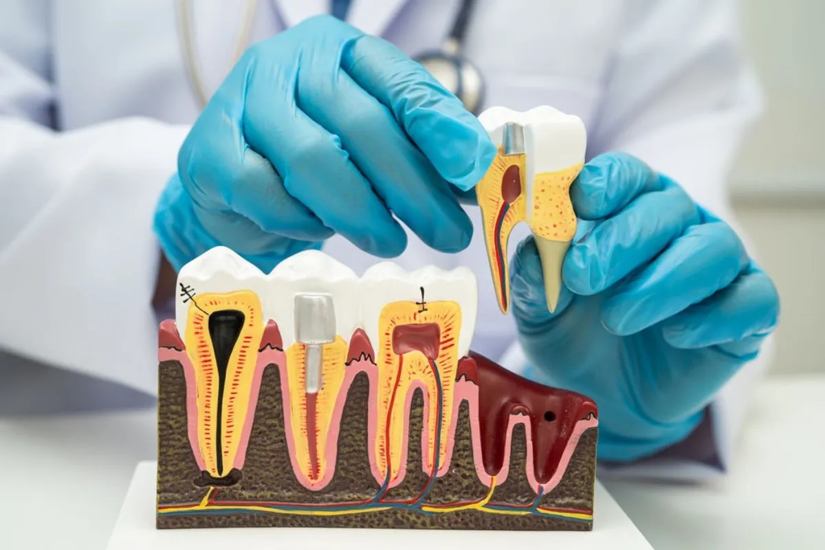 Hole In Tooth Hurts: Amazing Best Relief