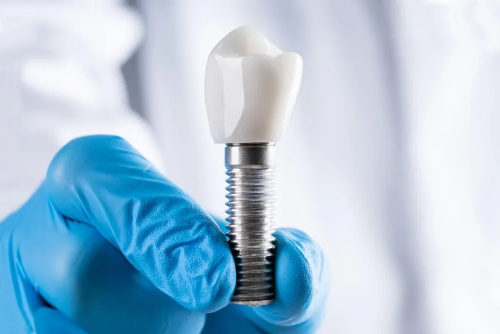 What Are Implants Made Of? Amazing Facts