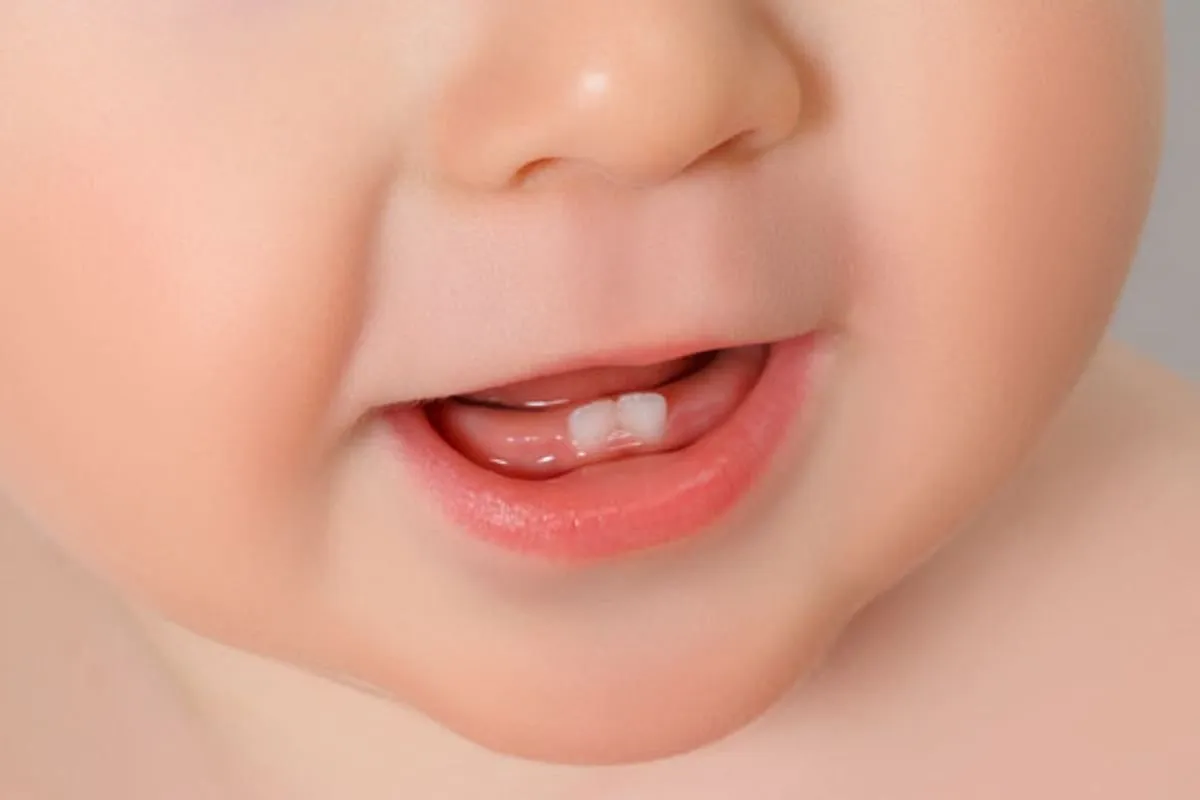 First Signs Of Wisdom Teeth Coming In: Best