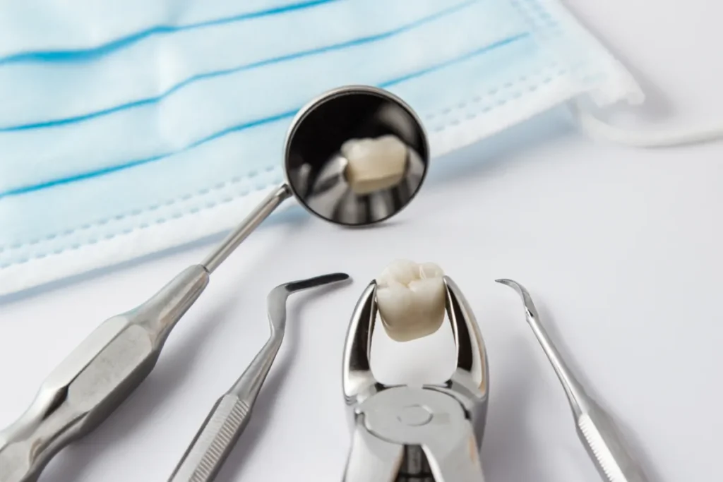 Understanding Post-Extraction Healing Process